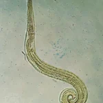 Pinworm Treatments