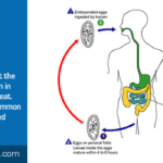 Should Pinworm Treatments Include Bedding Sanitization