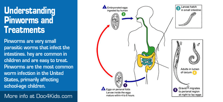 Should Pinworm Treatments Include Bedding Sanitization