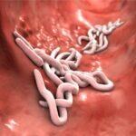 What Make Pinworm Treatments Work Quickly