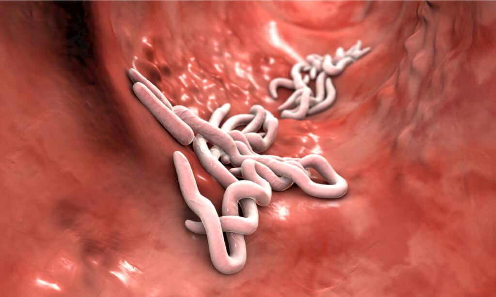 What Make Pinworm Treatments Work Quickly